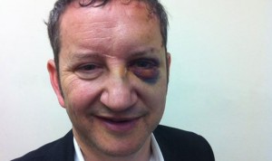 Harold Gerstel, un joyero reconocido por su publicidad en TV, fue fuertemente golpeado en una de sus tiendas que fue atracada.